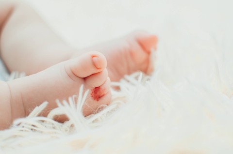 Tanda lahir pada bayi. Foto: komokvm/Shutterstock