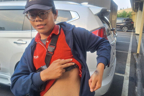 Tagih Uang COD Rp30 Ribu, Kurir di Bekasi Disabet Pedang oleh Pelanggan